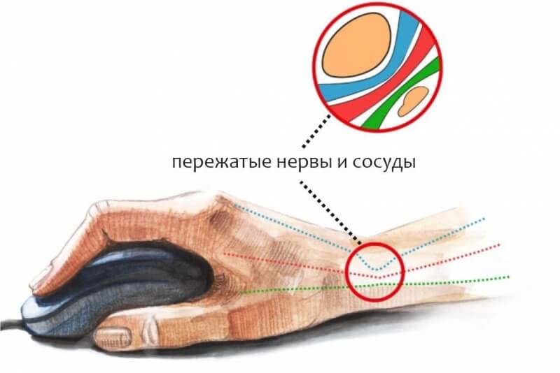 Кракен это наркозависимость